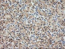 Invitrogen PDXK Monoclonal Antibody (OTI3G2) 100 &mu;L | Buy Online | Invitrogen&trade; | Fisher Scientific