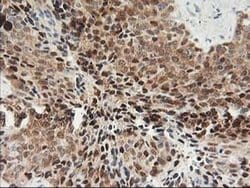 Invitrogen PDXK Monoclonal Antibody (OTI3G2) 100 &mu;L | Buy Online | Invitrogen&trade; | Fisher Scientific