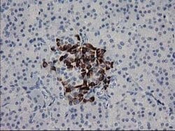 Invitrogen RGS5 Monoclonal Antibody (OTI1C1) 100 &mu;L; Unconjugated:Antibodies,