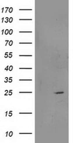 Invitrogen RGS5 Monoclonal Antibody (OTI1C1) 100 &mu;L; Unconjugated:Antibodies,