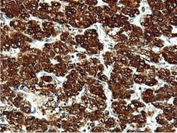 Invitrogen ILVBL Monoclonal Antibody (OTI8A12) 100 &mu;L; Unconjugated:Antibodies,