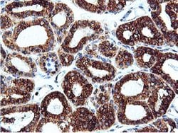 Invitrogen ILVBL Monoclonal Antibody (OTI8A12) 100 &mu;L; Unconjugated:Antibodies,