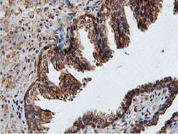 Invitrogen ILVBL Monoclonal Antibody (OTI8A12) 100 &mu;L; Unconjugated:Antibodies,