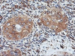 Invitrogen ILVBL Monoclonal Antibody (OTI8B12) 100 &mu;L | Buy Online | Invitrogen&trade; | Fisher Scientific