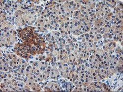 Invitrogen ILVBL Monoclonal Antibody (OTI8B12) 100 &mu;L | Buy Online | Invitrogen&trade; | Fisher Scientific