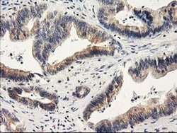 Invitrogen ILVBL Monoclonal Antibody (OTI1A12) 100 &mu;L; Unconjugated:Antibodies,