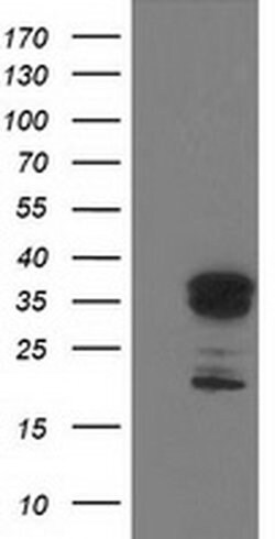Invitrogen LENG1 Monoclonal Antibody (OTI1G5) 100 &mu;L; Unconjugated:Antibodies,