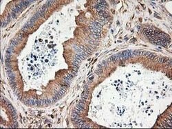 Invitrogen beta-4 Tubulin Monoclonal Antibody (OTI5C1) 100 &mu;L; Unconjugated:Antibodies,