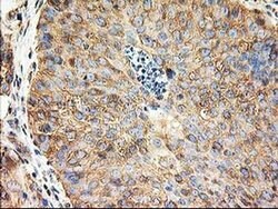 Invitrogen beta-4 Tubulin Monoclonal Antibody (OTI5C1) 100 &mu;L; Unconjugated:Antibodies,