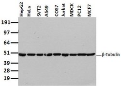 Invitrogen beta-4 Tubulin Monoclonal Antibody (OTI5C1) 100 &mu;L; Unconjugated:Antibodies,