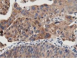 Invitrogen OSBP Monoclonal Antibody (OTI1F2) 100 &mu;L; Unconjugated:Antibodies,