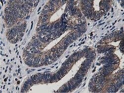 Invitrogen ATG3 Monoclonal Antibody (OTI2C12) 100 &mu;L; Unconjugated:Antibodies,
