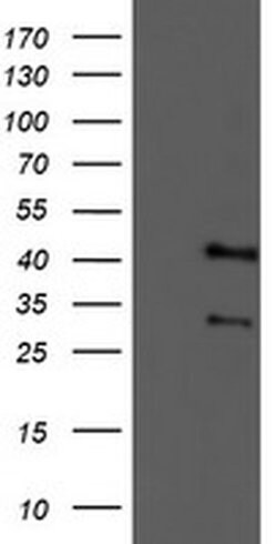 Invitrogen TMOD1 Monoclonal Antibody (OTI2C2) 100 &mu;L | Buy Online | Invitrogen&trade; | Fisher Scientific
