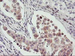 Invitrogen PHF21B Monoclonal Antibody (OTI3D1) 100 &mu;L; Unconjugated:Antibodies,