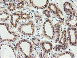 Invitrogen PHF21B Monoclonal Antibody (OTI3D1) 100 &mu;L; Unconjugated:Antibodies,