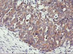 Invitrogen PHF21B Monoclonal Antibody (OTI3D1) 100 &mu;L; Unconjugated:Antibodies,