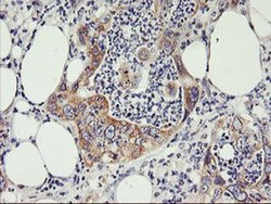 Invitrogen PHF21B Monoclonal Antibody (OTI3D1) 100 &mu;L; Unconjugated:Antibodies,