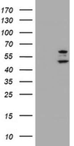Invitrogen PHF21B Monoclonal Antibody (OTI3D1) 100 &mu;L; Unconjugated:Antibodies,