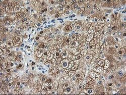 Invitrogen Aminoacylase Monoclonal Antibody (OTI1D4) 100 &mu;L; Unconjugated:Antibodies,