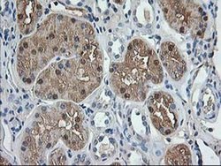 Invitrogen Aminoacylase Monoclonal Antibody (OTI1D4) 100 &mu;L; Unconjugated:Antibodies,