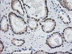 Invitrogen Aminoacylase Monoclonal Antibody (OTI1D4) 100 &mu;L; Unconjugated:Antibodies,