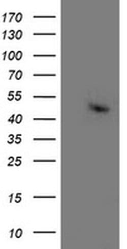 Invitrogen Aminoacylase Monoclonal Antibody (OTI1D4) 100 &mu;L; Unconjugated:Antibodies,