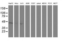 Invitrogen Aminoacylase Monoclonal Antibody (OTI1D4) 100 &mu;L; Unconjugated:Antibodies,
