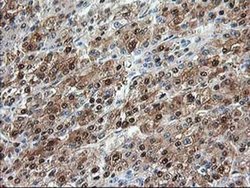 Invitrogen Aminoacylase Monoclonal Antibody (OTI2D3) 100 &mu;L; Unconjugated:Antibodies,