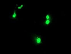 Invitrogen UBOX5 Monoclonal Antibody (OTI5A2) 100 &mu;L; Unconjugated:Antibodies,