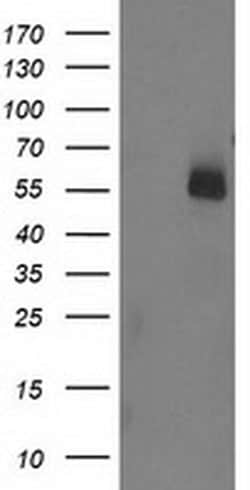 Invitrogen UBOX5 Monoclonal Antibody (OTI5A2) 100 &mu;L; Unconjugated:Antibodies,