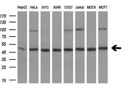 Invitrogen EBP1 Monoclonal Antibody (OTI1D3) 100 &mu;L; Unconjugated:Antibodies,