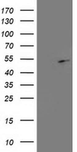 Invitrogen EBP1 Monoclonal Antibody (OTI1D3) 100 &mu;L; Unconjugated:Antibodies,