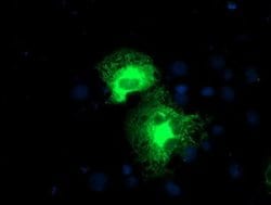 Invitrogen PSMD2 Monoclonal Antibody (OTI1G6) 100 &mu;L; Unconjugated:Antibodies,