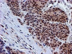 Invitrogen PSMD2 Monoclonal Antibody (OTI1G6) 100 &mu;L; Unconjugated:Antibodies,