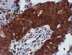 Invitrogen PSMD2 Monoclonal Antibody (OTI1G6) 100 &mu;L; Unconjugated:Antibodies,