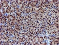 Invitrogen PSMD2 Monoclonal Antibody (OTI1G6) 100 &mu;L; Unconjugated:Antibodies,