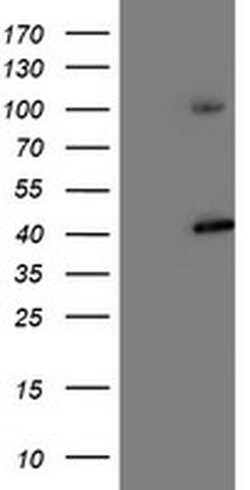 Invitrogen PSMD2 Monoclonal Antibody (OTI1G6) 100 &mu;L; Unconjugated:Antibodies,