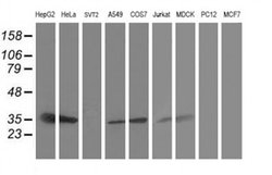 Invitrogen TRAP alpha Monoclonal Antibody (OTI3E5) 100 &mu;L; Unconjugated:Antibodies,
