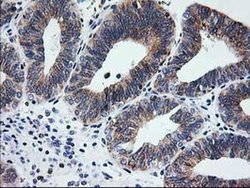Invitrogen TRAP alpha Monoclonal Antibody (OTI4C7) 100 &mu;L; Unconjugated:Antibodies,