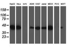 Invitrogen TRAP alpha Monoclonal Antibody (OTI4C7) 100 &mu;L; Unconjugated:Antibodies,