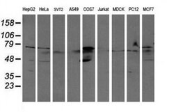 Invitrogen ALDH3A2 Monoclonal Antibody (OTI2D3) 100 &mu;L; Unconjugated:Antibodies,