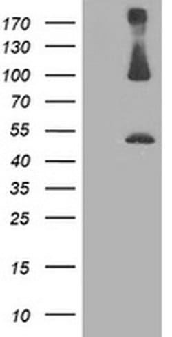 Invitrogen PSMD2 Monoclonal Antibody (OTI1G8) 100 &mu;L; Unconjugated:Antibodies,