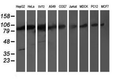 Invitrogen PSMD2 Monoclonal Antibody (OTI1G8) 100 &mu;L; Unconjugated:Antibodies,