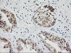 Invitrogen BAIAP2 Monoclonal Antibody (OTI8G8) 100 &mu;L; Unconjugated:Antibodies,