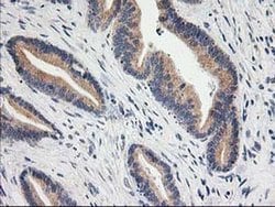 Invitrogen BAIAP2 Monoclonal Antibody (OTI8G8) 100 &mu;L; Unconjugated:Antibodies,