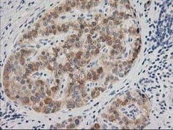 Invitrogen BAIAP2 Monoclonal Antibody (OTI8G8) 100 &mu;L; Unconjugated:Antibodies,