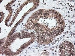 Invitrogen NUDT9 Monoclonal Antibody (OTI7A12) 100 &mu;L; Unconjugated:Antibodies,