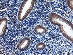 Invitrogen NUDT9 Monoclonal Antibody (OTI7A12) 100 &mu;L; Unconjugated:Antibodies,