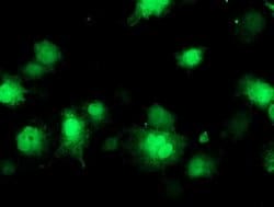 Invitrogen CoA Synthase Monoclonal Antibody (OTI3B3) 100 &mu;L; Unconjugated:Antibodies,