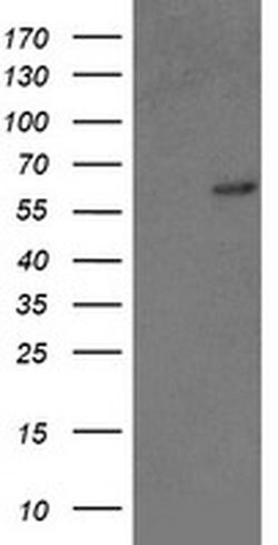 Invitrogen GTF2F1 Monoclonal Antibody (OTI1D5) 100 &mu;L; Unconjugated:Antibodies,